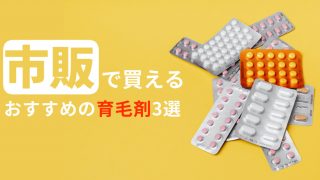 【お金の無駄】M字ハゲは市販の育毛剤では治らない！発毛剤を使うべき